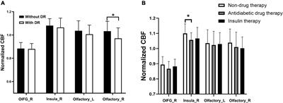 Alterations of Cerebral Blood Flow and Its Connectivity in Olfactory-Related Brain Regions of Type 2 Diabetes Mellitus Patients